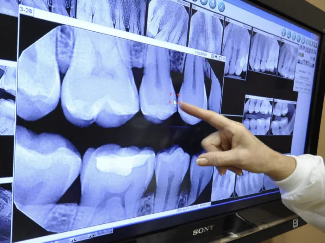 Una radiografía dental digital en una pantalla